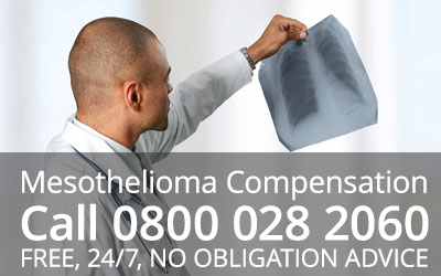 No Win No Fee Mesothelioma Claims