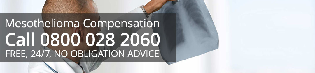 No Win No Fee Mesothelioma Claims